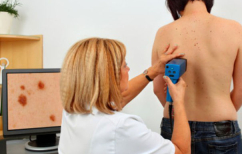 ΝΕΑ ΕΙΔΗΣΕΙΣ (Βήματα προόδου κατά του καρκίνου του δέρματος (ΒΙΝΤΕΟ))