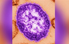 ΝΕΑ ΕΙΔΗΣΕΙΣ («Επίθεση» ιλαράς στις ΗΠΑ)