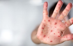 ΝΕΑ ΕΙΔΗΣΕΙΣ (Ένας 17χρονος στην Πάτρα το δεύτερο θύμα της ιλαράς)